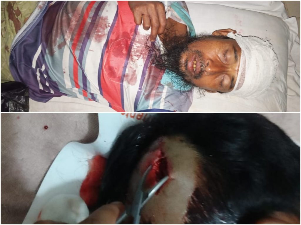 ধামইরহাটে সালিশে শাসনের জের, মামা শ্বশুরকে হত্যা চেষ্টার অভিযোগে ভাগ্নি জামাই গ্রেফতার