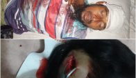 ধামইরহাটে সালিশে শাসনের জের, মামা শ্বশুরকে হত্যা চেষ্টার অভিযোগে ভাগ্নি জামাই গ্রেফতার