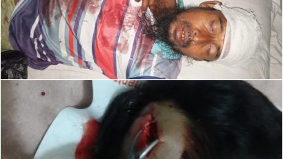 ধামইরহাটে সালিশে শাসনের জের, মামা শ্বশুরকে হত্যা চেষ্টার অভিযোগে ভাগ্নি জামাই গ্রেফতার