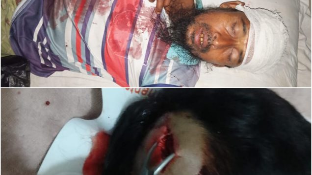 ধামইরহাটে সালিশে শাসনের জের, মামা শ্বশুরকে হত্যা চেষ্টার অভিযোগে ভাগ্নি জামাই গ্রেফতার